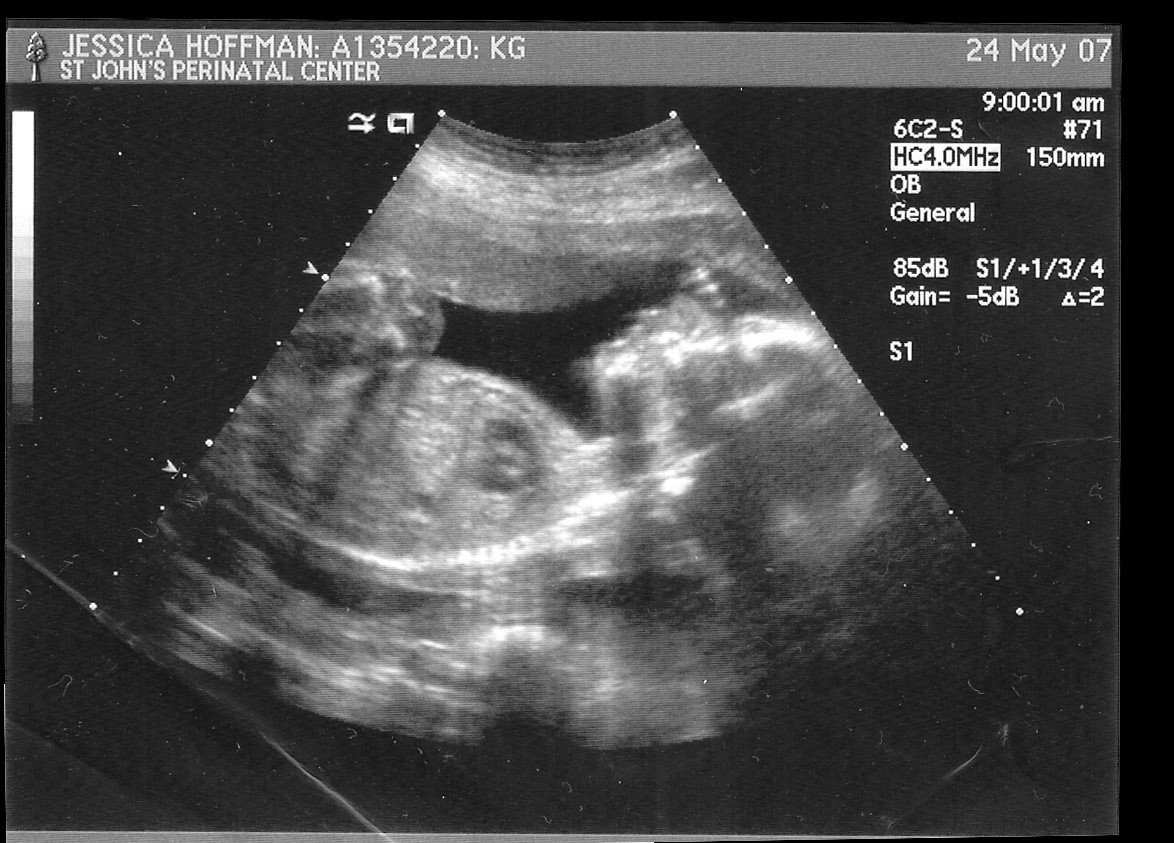 Partial Body Profile w/Heart. week23_scan7 .jpg. Uploaded by Erik Hoffmann on 5/28/2007. 
